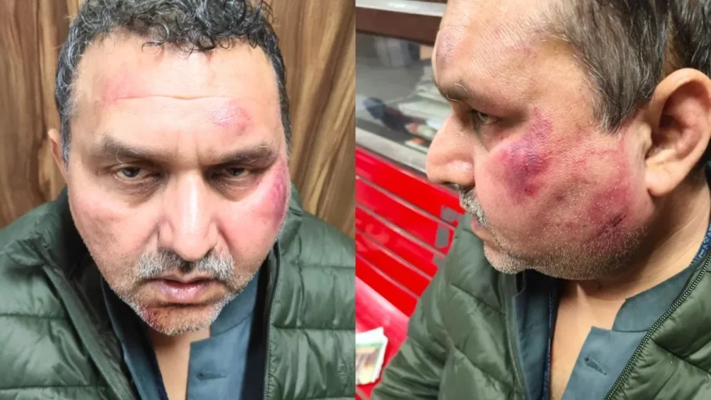 बदमाशों ने घर में घुसकर मचाया तांडव