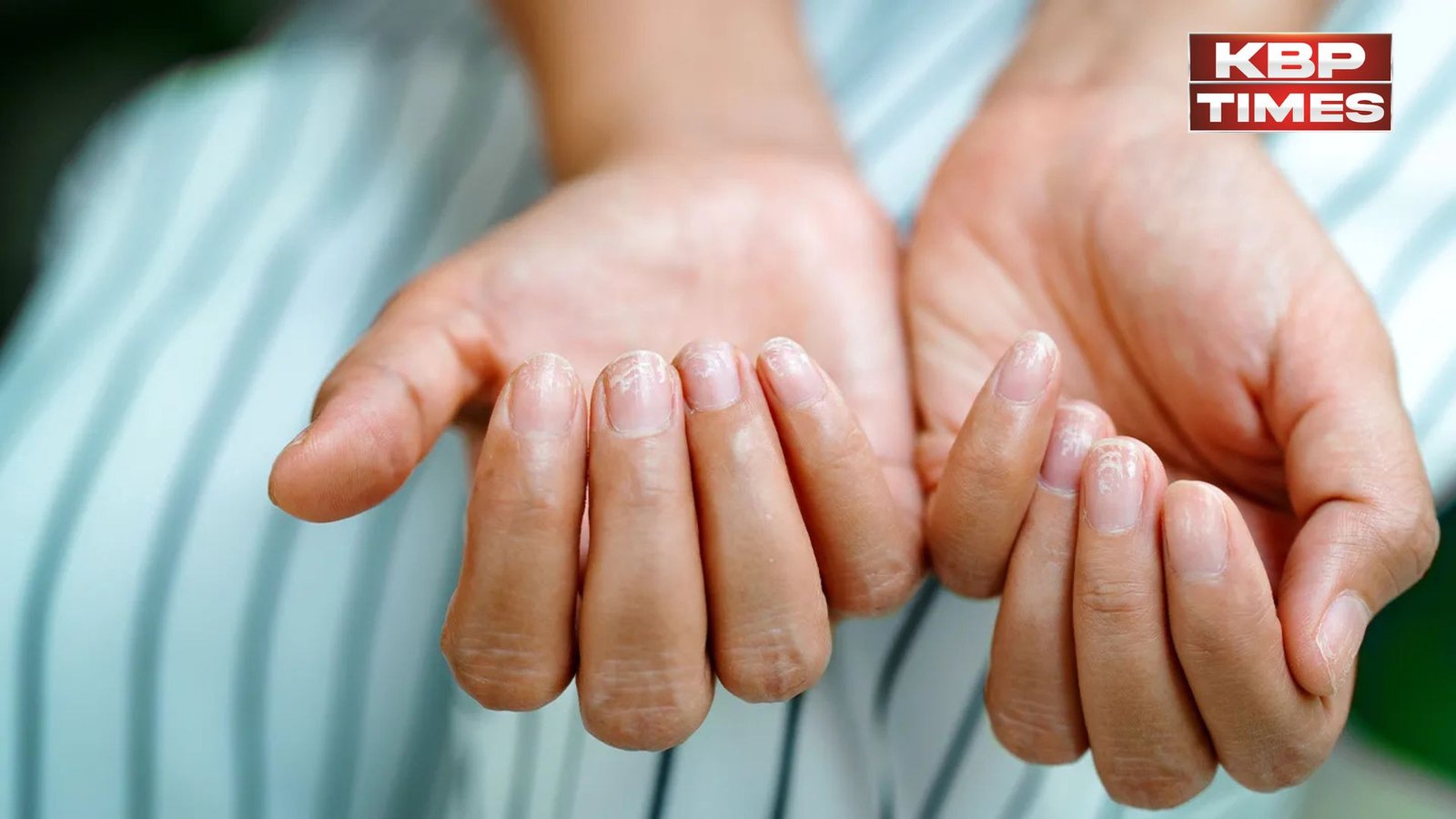 Nails Reveal About Your Health : नाखून बता सकते हैं सेहत का राज