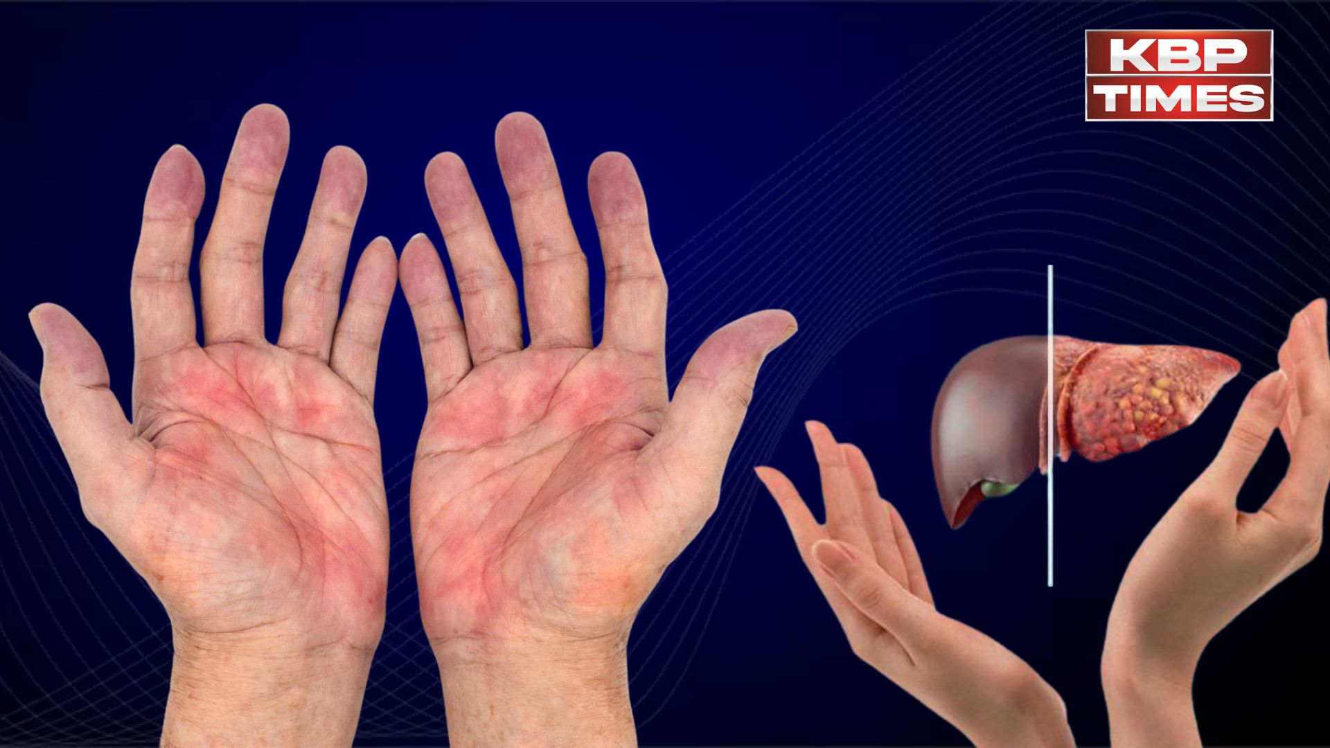 Liver Disease Warning Signs : ये लक्षण नजरअंदाज न करें