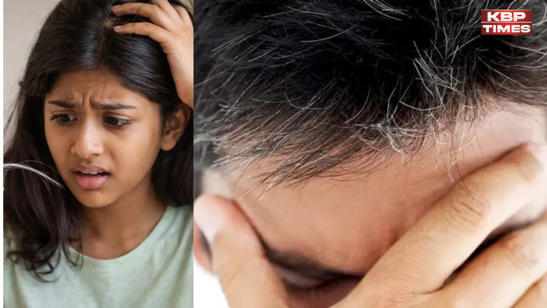 white hair in youth