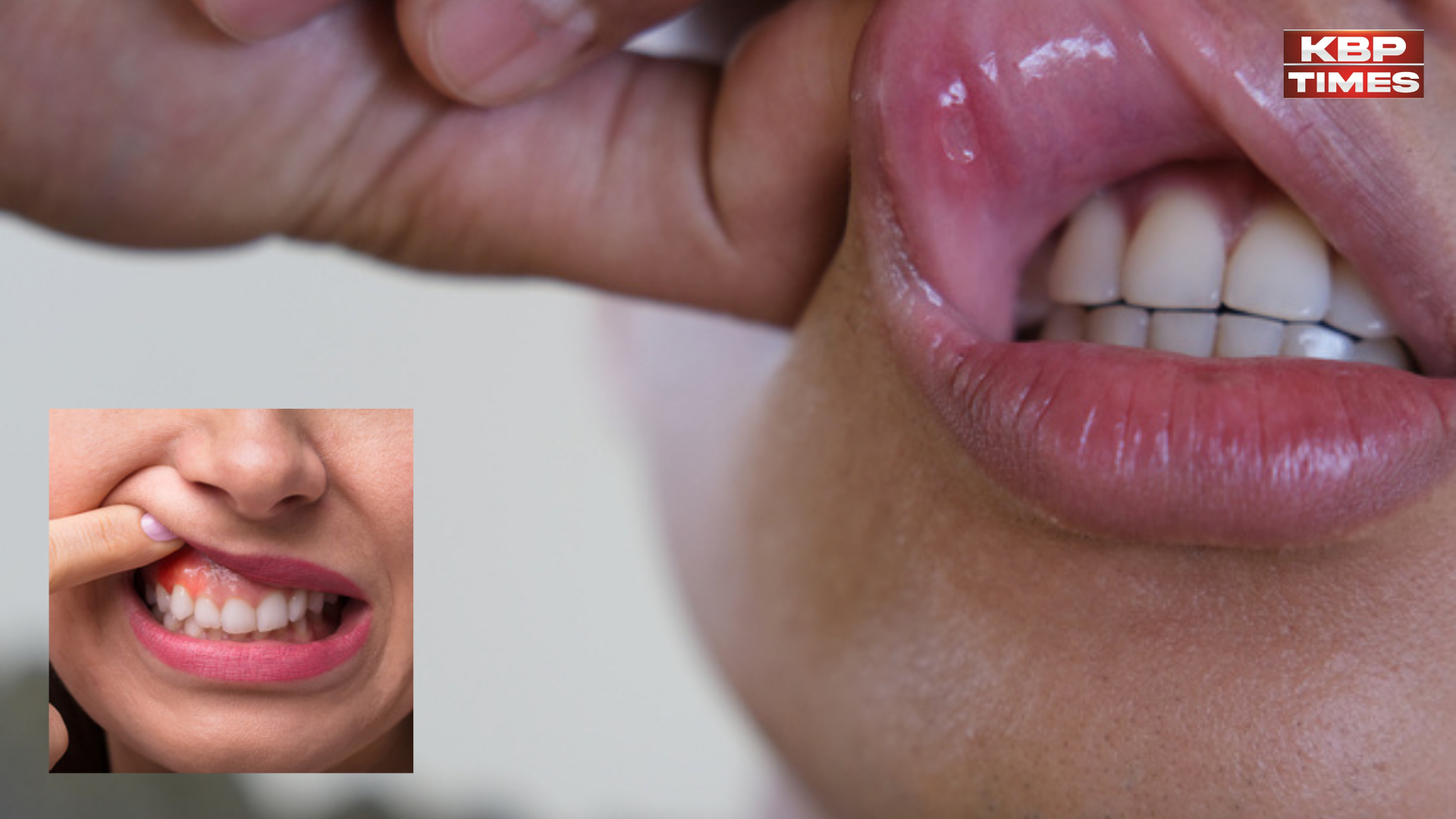 cancer mouth may be